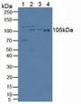 Western Blot; Sample: Lane1: Porcine Liver Tissue; Lane2: Human Hela Cells; Lane3: Human Lung Tissue; Lane4: Human A549 Cells. Western Blot; Sample: Lane1: Porcine Liver Tissue; Lane2: Human Hela Cells; Lane3: Human Lung Tissue; Lane4: Human A549 Cells.