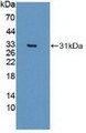 Western Blot; Sample: Recombinant IREB2, Human. Western Blot; Sample: Recombinant IREB2, Human.