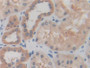 DAB staining on IHC-P; Samples: Human Kidney Tissue. DAB staining on IHC-P; Samples: Human Kidney Tissue.