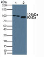 Western Blot; Sample: Lane1: Human Serum; Lane2: Porcine Heart Tissue. Western Blot; Sample: Lane1: Human Serum; Lane2: Porcine Heart Tissue.