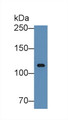 Western Blot; Sample: Human Serum; Primary Ab: 5µg/ml Rabbit Anti-Human ITIH3 Antibody Second Ab: 0.2µg/mL HRP-Linked Caprine Anti-Rabbit IgG Polyclonal Antibody Western Blot; Sample: Human Serum; Primary Ab: 5µg/ml Rabbit Anti-Human ITIH3 Antibody Second Ab: 0.2µg/mL HRP-Linked Caprine Anti-Rabbit IgG Polyclonal Antibody