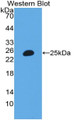 Western Blot; Sample: Recombinant protein. Western Blot; Sample: Recombinant protein.