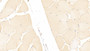 DAB staining on IHC-P; Samples: Human Skeletal muscle Tissue;  Primary Ab: 20μg/ml Rabbit Anti-Human ITIH3 Antibody Second Ab: 2µg/mL HRP-Linked Caprine Anti-Rabbit IgG Polyclonal Antibody  DAB staining on IHC-P; Samples: Human Skeletal muscle Tissue;  Primary Ab: 20μg/ml Rabbit Anti-Human ITIH3 Antibody Second Ab: 2µg/mL HRP-Linked Caprine Anti-Rabbit IgG Polyclonal Antibody