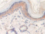 DAB staining on IHC-P; Samples: Rat Skin Tissue; Primary Ab: 10µg/ml Rabbit Anti-Rat LXN Antibody Second Ab: 2µg/mL HRP-Linked Caprine Anti-Rabbit IgG Polyclonal Antibody