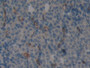 DAB staining on fromalin fixed paraffin- embedded stomach tissue) DAB staining on fromalin fixed paraffin- embedded stomach tissue)
