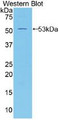 Western Blot; Sample: Recombinant protein. Western Blot; Sample: Recombinant protein.