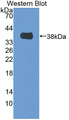 Western Blot; Sample: Recombinant protein. Western Blot; Sample: Recombinant protein.