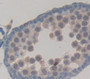 N-Acetylgalactosaminidase Alpha (NAGa) Polyclonal Antibody, Cat#CAU21931 N-Acetylgalactosaminidase Alpha (NAGa) Polyclonal Antibody, Cat#CAU21931
