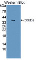 Western Blot; Sample: Recombinant protein. Western Blot; Sample: Recombinant protein.