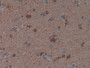 DAB staining on IHC-P; Samples: Human Brain Tissue;  Primary Ab: 10µg/ml Rabbit Anti-Human PAK1 Anti