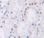 Polybromo 1 (PBRM1) Polyclonal Antibody, Cat#CAU21964 Polybromo 1 (PBRM1) Polyclonal Antibody, Cat#CAU21964