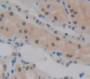 Polybromo 1 (PBRM1) Polyclonal Antibody, Cat#CAU21965 Polybromo 1 (PBRM1) Polyclonal Antibody, Cat#CAU21965