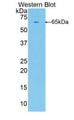 Western Blot; Sample: Recombinant protein. Western Blot; Sample: Recombinant protein.