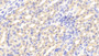 DAB staining on fromalin fixed paraffin-embedded Brain tissue) DAB staining on fromalin fixed paraffin-embedded Brain tissue)