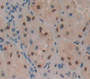Pleiomorphic Adenoma Gene Like Protein 1 (PLAGL1) Polyclonal Antibody, Cat#CAU21975