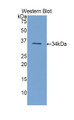 Western Blot; Sample: Recombinant protein. Western Blot; Sample: Recombinant protein.