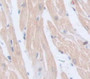 Periostin (POSTN) Polyclonal Antibody, Cat#CAU21992 Periostin (POSTN) Polyclonal Antibody, Cat#CAU21992