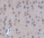 Used in DAB staining on fromalin fixed paraffin- embedded Kidney tissue