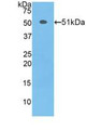 Western Blot; Sample: Recombinant TFAM, Mouse. Western Blot; Sample: Recombinant TFAM, Mouse.