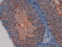 DAB staining on IHC-P; Samples: Mouse Testis Tissue; Primary Ab: 20µg/ml Rabbit Anti-Mouse TFAM Antibody Second Ab: 2µg/mL HRP-Linked Caprine Anti-Rabbit IgG Polyclonal Antibody DAB staining on IHC-P; Samples: Mouse Testis Tissue; Primary Ab: 20µg/ml Rabbit Anti-Mouse TFAM Antibody Second Ab: 2µg/mL HRP-Linked Caprine Anti-Rabbit IgG Polyclonal Antibody