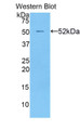Western Blot; Sample: Recombinant protein. Western Blot; Sample: Recombinant protein.