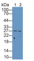 Western Blot; Sample: Lane1: Human HepG2 cell lysate; Lane2: Human Hela cell lysate; Primary Ab: 2µg/mL Rabbit Anti-Human TFAM Antibody; Second Ab: 0.2µg/mL HRP-Linked Caprine Anti-Rabbit IgG Polyclonal Antibody; Western Blot; Sample: Lane1: Human HepG2 cell lysate; Lane2: Human Hela cell lysate; Primary Ab: 2µg/mL Rabbit Anti-Human TFAM Antibody; Second Ab: 0.2µg/mL HRP-Linked Caprine Anti-Rabbit IgG Polyclonal Antibody;