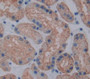 Transcription Factor A, Mitochondrial (TFAM) Polyclonal Antibody, Cat#CAU22073 Transcription Factor A, Mitochondrial (TFAM) Polyclonal Antibody, Cat#CAU22073