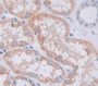 Talin 2 (TLN2) Polyclonal Antibody, Cat#CAU22085