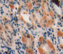DAB staining on fromalin fixed paraffin-embedded stomach tissue) DAB staining on fromalin fixed paraffin-embedded stomach tissue)