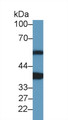Western Blot; Sample: Rat Heart lysate; Primary Ab: 1µg/ml Rabbit Anti-Mouse ANKRD1 Antibody Second Ab: 0.2µg/mL HRP-Linked Caprine Anti-Rabbit IgG Polyclonal Antibody Western Blot; Sample: Rat Heart lysate; Primary Ab: 1µg/ml Rabbit Anti-Mouse ANKRD1 Antibody Second Ab: 0.2µg/mL HRP-Linked Caprine Anti-Rabbit IgG Polyclonal Antibody