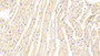 DAB staining on IHC-P; Samples: Mouse Cardiac Muscle Tissue;  Primary Ab: 20μg/ml Rabbit Anti-Mouse ANKRD1 Antibody Second Ab: 2µg/mL HRP-Linked Caprine Anti-Rabbit IgG Polyclonal Antibody  DAB staining on IHC-P; Samples: Mouse Cardiac Muscle Tissue;  Primary Ab: 20μg/ml Rabbit Anti-Mouse ANKRD1 Antibody Second Ab: 2µg/mL HRP-Linked Caprine Anti-Rabbit IgG Polyclonal Antibody