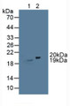 Western Blot; Sample: Lane1: Mouse Brain Tissue; Lane2: Porcine Brain Tissue. Western Blot; Sample: Lane1: Mouse Brain Tissue; Lane2: Porcine Brain Tissue.
