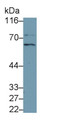 Western Blot; Sample: Recombinant protein. Western Blot; Sample: Recombinant protein.