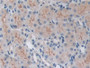 DAB staining on IHC-P; Samples: Mouse Kidney Tissue; Primary Ab: 10µg/ml Rabbit Anti-Mouse TRAF6 Antibody Second Ab: 2µg/mL HRP-Linked Caprine Anti-Rabbit IgG Polyclonal Antibody DAB staining on IHC-P; Samples: Mouse Kidney Tissue; Primary Ab: 10µg/ml Rabbit Anti-Mouse TRAF6 Antibody Second Ab: 2µg/mL HRP-Linked Caprine Anti-Rabbit IgG Polyclonal Antibody
