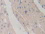 DAB staining on fromalin fixed paraffin-embedded liver tissue) DAB staining on fromalin fixed paraffin-embedded liver tissue)