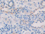 DAB staining on IHC-P; Samples: Human Kidney Tissue; Primary Ab: 10µg/ml Rabbit Anti-Human MAPRE1 Antibody Second Ab: 2µg/mL HRP-Linked Caprine Anti-Rabbit IgG Polyclonal Antibody DAB staining on IHC-P; Samples: Human Kidney Tissue; Primary Ab: 10µg/ml Rabbit Anti-Human MAPRE1 Antibody Second Ab: 2µg/mL HRP-Linked Caprine Anti-Rabbit IgG Polyclonal Antibody