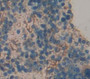 Endoplasmic Reticulum Aminopeptidase 2 (ERAP2) Polyclonal Antibody, Cat#CAU22244