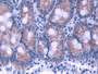 DAB staining on IHC-P; Samples: Rat Small intestine Tissue; Primary Ab: 20µg/ml Rabbit Anti-Rat ATP5b Antibody Second Ab: 2µg/mL HRP-Linked Caprine Anti-Rabbit IgG Polyclonal Antibody DAB staining on IHC-P; Samples: Rat Small intestine Tissue; Primary Ab: 20µg/ml Rabbit Anti-Rat ATP5b Antibody Second Ab: 2µg/mL HRP-Linked Caprine Anti-Rabbit IgG Polyclonal Antibody