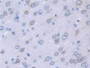 DAB staining on fromalin fixed paraffin- embedded liver tissue) DAB staining on fromalin fixed paraffin- embedded liver tissue)
