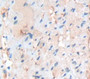 N-Acetyltransferase 2 (NAT2) Polyclonal Antibody, Cat#CAU22326 N-Acetyltransferase 2 (NAT2) Polyclonal Antibody, Cat#CAU22326