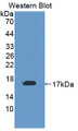 Western Blot; Sample: Recombinant protein.