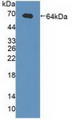 Western Blot; Sample: Recombinant gABRa2, Human. Western Blot; Sample: Recombinant gABRa2, Human.