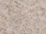 DAB staining on IHC-P; Samples: Human Liver Tissue;  Primary Ab: 10µg/ml Rabbit Anti-Human PRDX2 Ant DAB staining on IHC-P; Samples: Human Liver Tissue;  Primary Ab: 10µg/ml Rabbit Anti-Human PRDX2 Ant