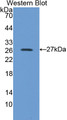 Western Blot; Sample: Recombinant protein. Western Blot; Sample: Recombinant protein.