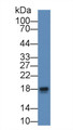 Western Blot; Sample: Rat Kidney lysate; ; Primary Ab: 2µg/mL Rabbit Anti-Rat PRDX5 Antibody; Second Ab: 0.2µg/mL HRP-Linked Caprine Anti-Rabbit IgG Polyclonal Antibody; Western Blot; Sample: Rat Kidney lysate; ; Primary Ab: 2µg/mL Rabbit Anti-Rat PRDX5 Antibody; Second Ab: 0.2µg/mL HRP-Linked Caprine Anti-Rabbit IgG Polyclonal Antibody;