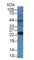 Western Blot; Sample: Rat Serum; Primary Ab: 2µg/mL Rabbit Anti-Mouse PRDX4 Antibody Second Ab: 0.2µg/mL HRP-Linked Caprine Anti-Rabbit IgG Polyclonal Antibody Western Blot; Sample: Rat Serum; Primary Ab: 2µg/mL Rabbit Anti-Mouse PRDX4 Antibody Second Ab: 0.2µg/mL HRP-Linked Caprine Anti-Rabbit IgG Polyclonal Antibody