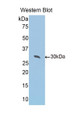 Western Blot; Sample: Recombinant protein. Western Blot; Sample: Recombinant protein.