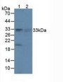 Western Blot; Lane1: Rat Brain Tissue; Lane2: Rat Lung Tissue. Western Blot; Lane1: Rat Brain Tissue; Lane2: Rat Lung Tissue.