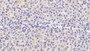 DAB staining on IHC-P; Samples: Human Liver Tissue; Primary Ab: 20μg/ml Rabbit Anti-Human PRDX4 Antibody Second Ab: 2µg/mL HRP-Linked Caprine Anti-Rabbit IgG Polyclonal Antibody DAB staining on IHC-P; Samples: Human Liver Tissue; Primary Ab: 20μg/ml Rabbit Anti-Human PRDX4 Antibody Second Ab: 2µg/mL HRP-Linked Caprine Anti-Rabbit IgG Polyclonal Antibody