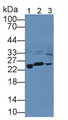 Western Blot; Sample: Lane1: Rat Kidney lysate; Lane2: Rat Spinal cord lysate; Lane3: Rat Serum; Primary Ab: 1µg/mL Rabbit Anti-Rat PRDX3 Antibody; Second Ab: 0.2µg/mL HRP-Linked Caprine Anti-Rabbit IgG Polyclonal Antibody; Western Blot; Sample: Lane1: Rat Kidney lysate; Lane2: Rat Spinal cord lysate; Lane3: Rat Serum; Primary Ab: 1µg/mL Rabbit Anti-Rat PRDX3 Antibody; Second Ab: 0.2µg/mL HRP-Linked Caprine Anti-Rabbit IgG Polyclonal Antibody;